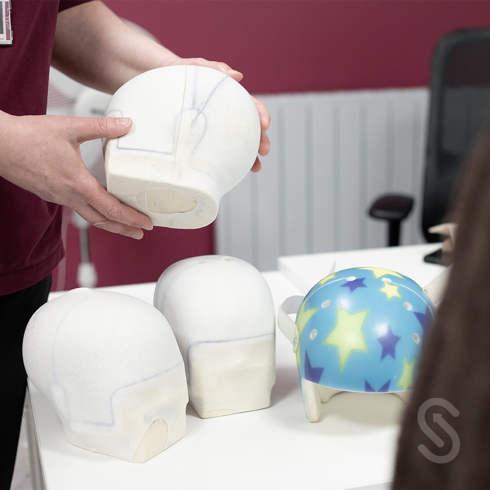Steeper Clinic now Guarantees One Helmet to all Patients Using STARBand Cranial Remoulding